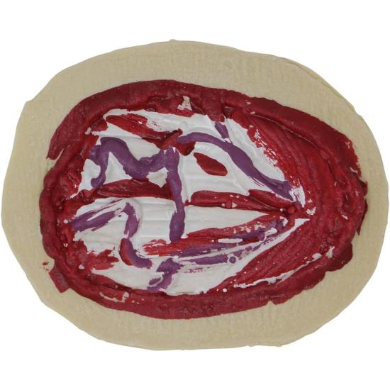 Cicatriz TENDONES Mano 10 CMS.Latex