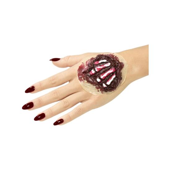 Herida Mano Tendones Fuera