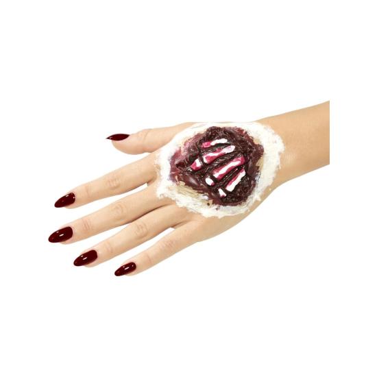 Herida Mano Tendones Fuera