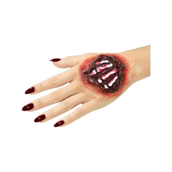 Herida Mano Tendones Fuera