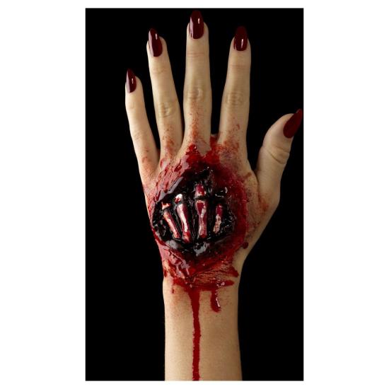 Herida Mano Tendones Fuera